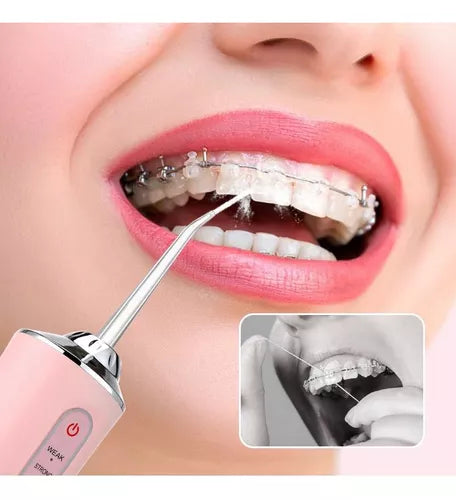 IRRIGADOR DENTAL (BUCAL)